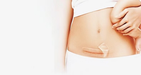 Zakaj so debele folije za brazgotine iz silikonskega gela tako priljubljene?